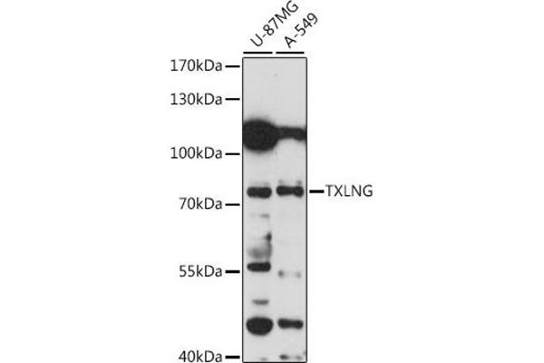 Taxilin gamma (TXLNG) (AA 1-140) 抗体