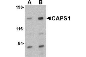 Western Blotting (WB) image for anti-Ca++-Dependent Secretion Activator (CADPS) (C-Term) antibody (ABIN1030309) (CADPS 抗体  (C-Term))