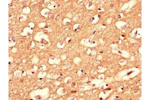 Immunohistochemistry of paraffin-embedded human brain tissue using ABIN7148421 at dilution of 1:100 (Complexin 1 抗体  (AA 1-134))