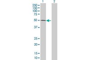 Western Blot analysis of ACP6 expression in transfected 293T cell line by ACP6 MaxPab polyclonal antibody. (ACP6 抗体  (AA 1-428))