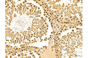 ABIN6262398 and ABIN6269012 at 1/100 staining Rat testis tissue by IHC-P. (HSP70 抗体  (C-Term))