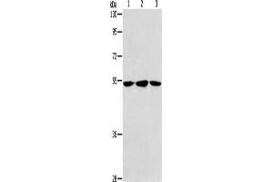 Gel: 8 % SDS-PAGE, Lysate: 40 μg, Lane 1-3: Human fetal liver tissue, hela cells, Human fetal brain tissue, Primary antibody: ABIN7189774(ALDH9A1 Antibody) at dilution 1/240, Secondary antibody: Goat anti rabbit IgG at 1/8000 dilution, Exposure time: 30 seconds (ALDH9A1 抗体)