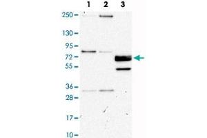 Western Blot analysis of Lane 1: RT-4, Lane 2: U-251MG sp and Lane 3: human plasma (IgG/HSA depleted) with CUX1 polyclonal antibody . (CUX1 抗体)