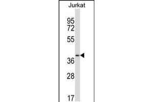 Western blot analysis in Jurkat cell line lysates (35ug/lane). (PAQR6 抗体  (C-Term))