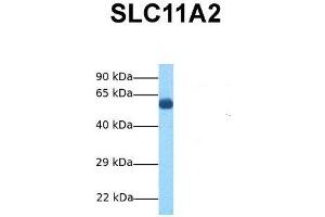 Host:  Rabbit  Target Name:  SLC11A2  Sample Tissue:  Human Fetal Lung  Antibody Dilution:  1. (SLC11A2 抗体  (N-Term))