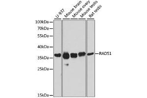 Western blot analysis of extracts of various cell lines, using RAD51 antibody. (RAD51 抗体  (AA 50-150))