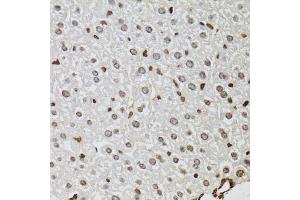 Immunohistochemistry of paraffin-embedded mouse liver using KDM4A antibody (ABIN5975678) at dilution of 1/100 (40x lens). (KDM4A 抗体)
