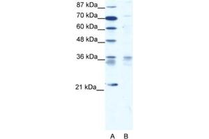 Western Blotting (WB) image for anti-BARX Homeobox 1 (BARX1) antibody (ABIN2460616) (BARX1 抗体)