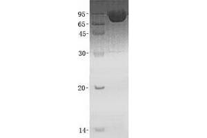 Validation with Western Blot (Thimet Oligopeptidase 1 Protein (THOP1) (His tag))
