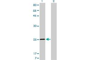 Western Blot analysis of TNNI3 expression in transfected 293T cell line by TNNI3 monoclonal antibody (M04), clone 1E7. (TNNI3 抗体  (AA 102-210))