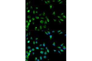 Immunofluorescence analysis of HeLa cell using RASSF1 antibody. (RASSF1 抗体  (AA 101-340))