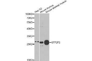 Western blot analysis of extracts of various cell lines, using GTF2F2 antibody. (GTF2F2 抗体)