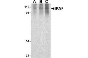 Western blot analysis of Ipaf in human PBL lysate with AP30437PU-N Ipaf antibody at 0. (NLRC4 抗体)