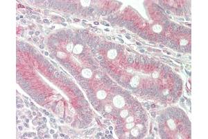 Human Small Intestine: Formalin-Fixed, Paraffin-Embedded (FFPE). (CCL25 抗体  (AA 24-150) (Biotin))