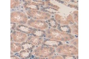 Used in DAB staining on fromalin fixed paraffin- embedded kidney tissue (MDH1 抗体  (AA 2-334))