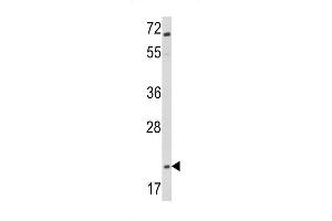 Western blot analysis of Glucagon Antibody (C-term) (ABIN390769 and ABIN2841027) in Jurkat cell line lysates (35 μg/lane). (Glucagon 抗体  (C-Term))