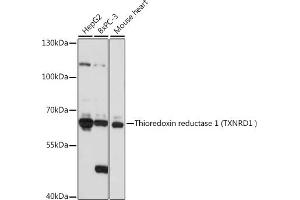 Western blot analysis of extracts of various cell lines, using Thioredoxin reductase 1 (Thioredoxin reductase 1 (TXNRD1 ) ) antibody (ABIN7270806) at 1:1000 dilution. (TXNRD1 抗体)