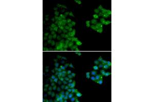 Immunofluorescence (IF) image for anti-Proteasome (Prosome, Macropain) Subunit, beta Type 10 (PSMB10) (AA 1-273) antibody (ABIN6146311)