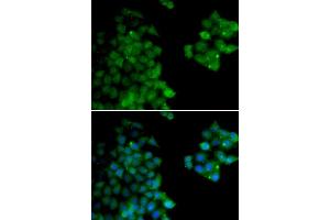 Immunofluorescence analysis of HeLa cells using PSMB10 antibody (ABIN6132527, ABIN6146311, ABIN6146312 and ABIN6221107). (PSMB10 抗体  (AA 1-273))