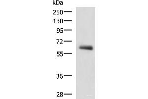 Western blot analysis of Human metastatic papillary carcinoma(thyroid cancer) tissue lysate using KBTBD11 Polyclonal Antibody at dilution of 1:2300 (KBTBD11 抗体)