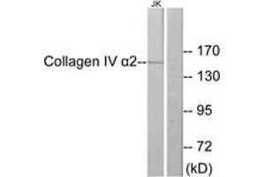 Western Blotting (WB) image for anti-Collagen, Type IV, alpha 2 (COL4A2) (AA 151-200) antibody (ABIN2889911) (COL4a2 抗体  (AA 151-200))