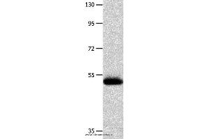 Western blot analysis of Human endometrial carcinoma tissue  , using MMP10 Polyclonal Antibody at dilution of 1:200 (MMP10 抗体)