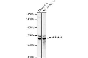 Western blot analysis of extracts of various cell lines, using HNRNPM antibody (ABIN7267635) at 1:1000 dilution. (HNRNPM 抗体)