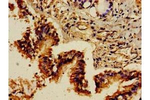 Immunohistochemistry of paraffin-embedded human lung tissue using ABIN7154494 at dilution of 1:100 (PIK3R1 抗体  (AA 15-180))