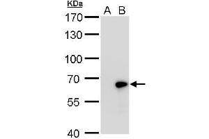 Western Blotting (WB) image for anti-Glutamate Decarboxylase 1 (Brain, 67kDa) (GAD1) (N-Term) antibody (ABIN2855214)