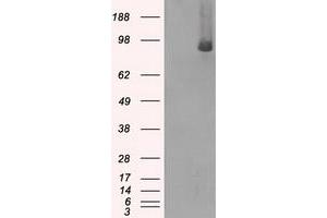 Western Blotting (WB) image for anti-B-Raf proto-oncogene, serine/threonine kinase (BRAF) antibody (ABIN1496953) (BRAF 抗体)