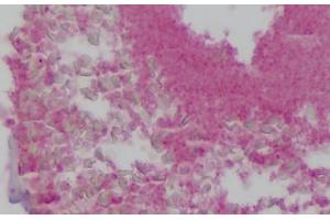 Human Colon: Formalin-Fixed, Paraffin-Embedded (FFPE) (GP1BB 抗体  (AA 56-118))