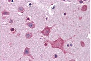 ABIN185398 (3. (DPP10 抗体  (Internal Region))