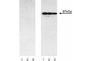 Western blot analysis of mouse Stat6 (pY641). (STAT6 抗体  (pTyr641))