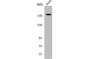 Western Blot analysis of HuvEc cells using ABCA8 Polyclonal Antibody (ABCA8 抗体  (Internal Region))