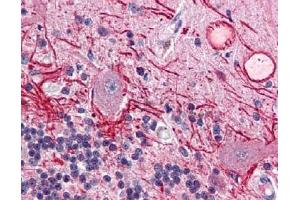 Immunohistochemistry (IHC) image for anti-V-Akt Murine Thymoma Viral Oncogene Homolog 1 (AKT1) (Thr308) antibody (ABIN400786) (AKT1 抗体  (Thr308))