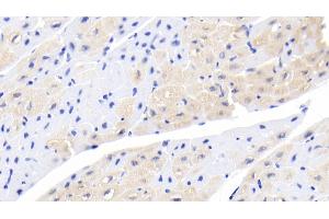 Detection of ACVR2A in Human Cardiac Muscle Tissue using Monoclonal Antibody to Activin A Receptor Type II A (ACVR2A)