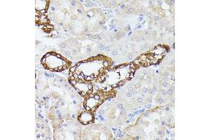 Immunohistochemistry of paraffin-embedded rat kidney using LTF antibody (ABIN6131498, ABIN6143382, ABIN6143383 and ABIN6216705) at dilution of 1:100 (40x lens). (Lactoferrin 抗体  (AA 500-710))