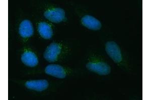 IF analysis of ZNRF3 using anti-ZNRF3 antibody (ABIN7602004). (ZNRF3 抗体  (AA 54-913))