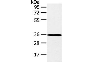 Western blot analysis of K562 cell and mouse brain tissue using E2F5 Polyclonal Antibody at dilution of 1:400 (E2F5 抗体)