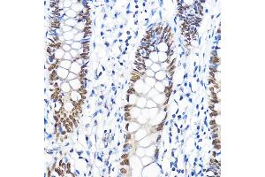 Immunohistochemistry (IHC) image for anti-General Transcription Factor IIB (GTF2B) (AA 50-150) antibody (ABIN7267370)