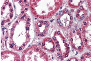 Immunohistochemistry (Formalin-fixed Paraffin-embedded Sections) (IHC (fp)) image for anti-TBC1 (Tre-2/USP6, BUB2, Cdc16) Domain Family, Member 1 (TBC1D1) (AA 612-661) antibody (ABIN6747172)