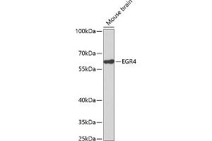 Western blot analysis of extracts of mouse brain, using EGR4 antibody (ABIN3016963, ABIN3016964, ABIN3016965 and ABIN1679681). (EGR4 抗体)