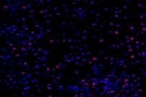 Immunofluorescent analysis of paraformaldehyde-fixed mouse kidney using,PNN (ABIN7075083) at dilution of 1: 800 (PNN 抗体)