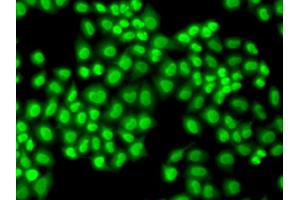 Immunofluorescence analysis of HeLa cells using GTF2F1 antibody (ABIN5971324).