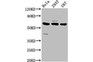 Western Blot Positive WB detected in: Hela whole cell lysate, 293T whole cell lysate, U87 whole cell lysate All lanes: NETO1 antibody at 3. (NETO1 抗体  (AA 367-507))