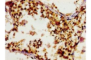 Immunohistochemistry (IHC) image for anti-Tubulin, gamma Complex Associated Protein 4 (TUBGCP4) (AA 203-309) antibody (ABIN7153569)