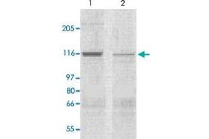 The tissue lysates derived from mouse heart (lane 1) or rat heart (lane 2) were immunoprobed by Corin polyclonal antibody  at 1 : 500. (Corin 抗体  (N-Term))