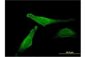 Immunofluorescence of monoclonal antibody to MB on HeLa cell. (Myoglobin 抗体  (AA 2-100))