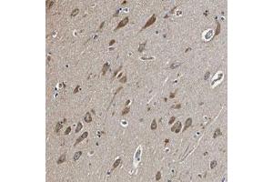 Immunohistochemical staining (Formalin-fixed paraffin-embedded sections) of human hippocampus with MIB1 polyclonal antibody  shows moderate cytoplasmic positivity in neuronal cells.