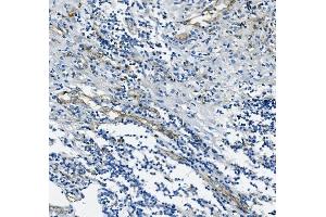 IHC analysis of CD31/PECAM1 using anti-CD31/PECAM1 antibody (ABIN7601076). (CD31 抗体  (AA 28-382))